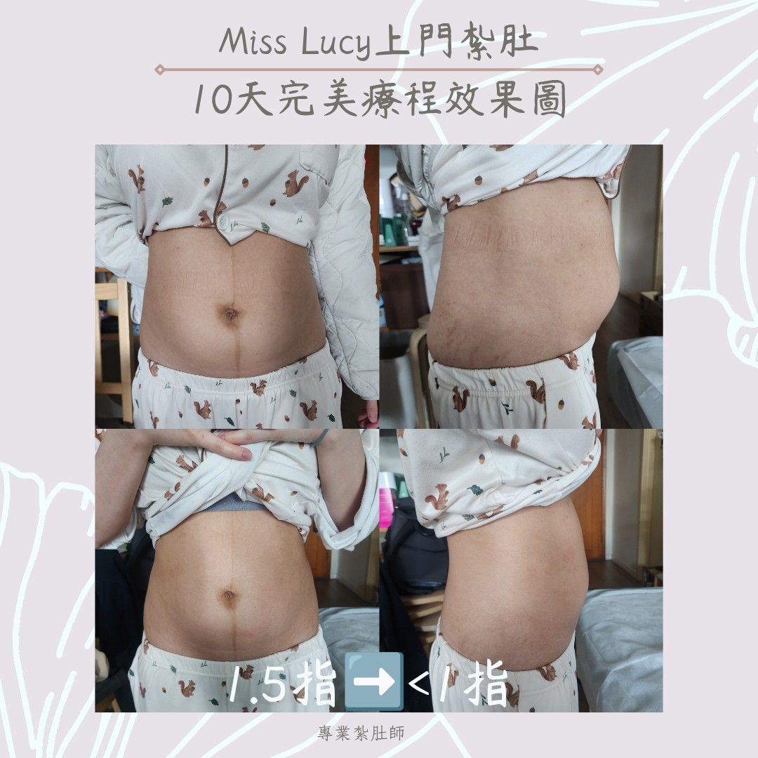 Miss Lucy 上門紮肚療程效果圖 6