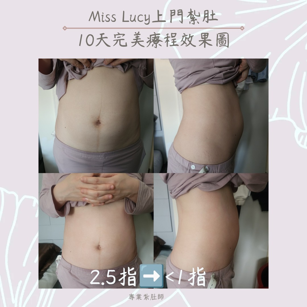 Miss Lucy 上門紮肚療程效果圖 11