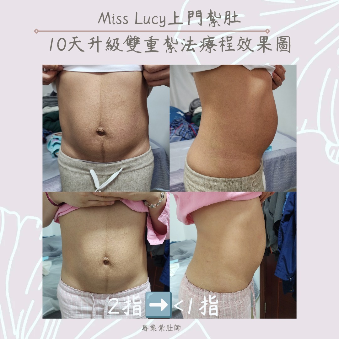 Miss Lucy 上門紮肚療程效果圖 14