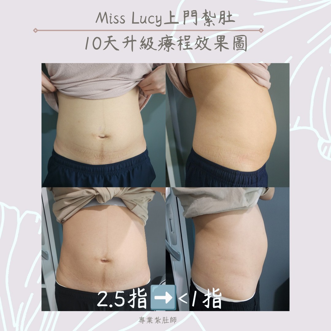 Miss Lucy 上門紮肚療程效果圖 16