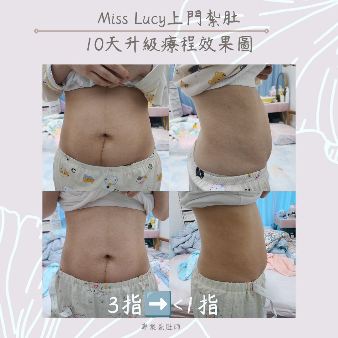 Miss Lucy 上門紮肚療程效果圖 22
