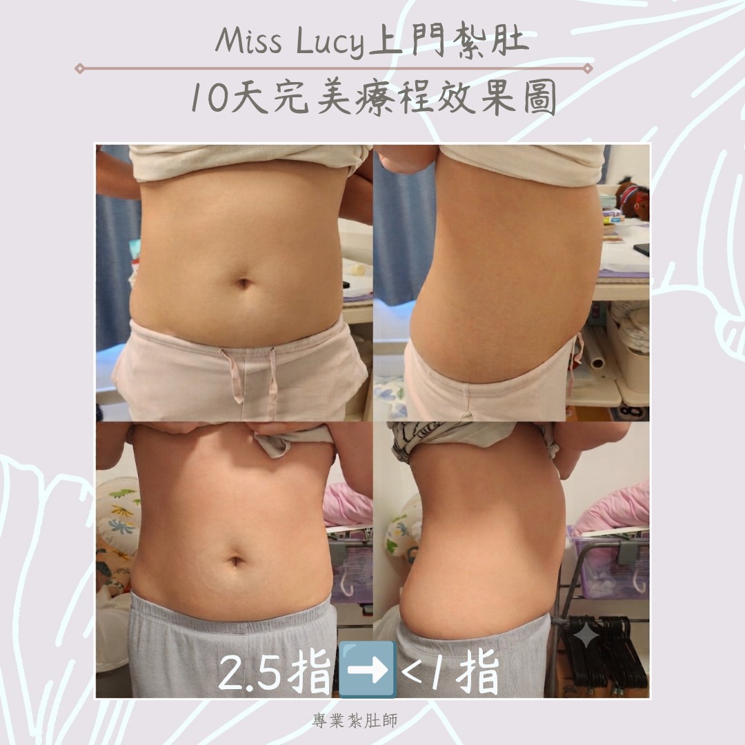 Miss Lucy 上門紮肚療程效果圖 24